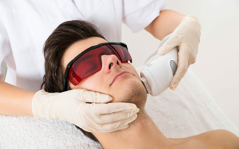 facial laser hair removal for men Los Angeles